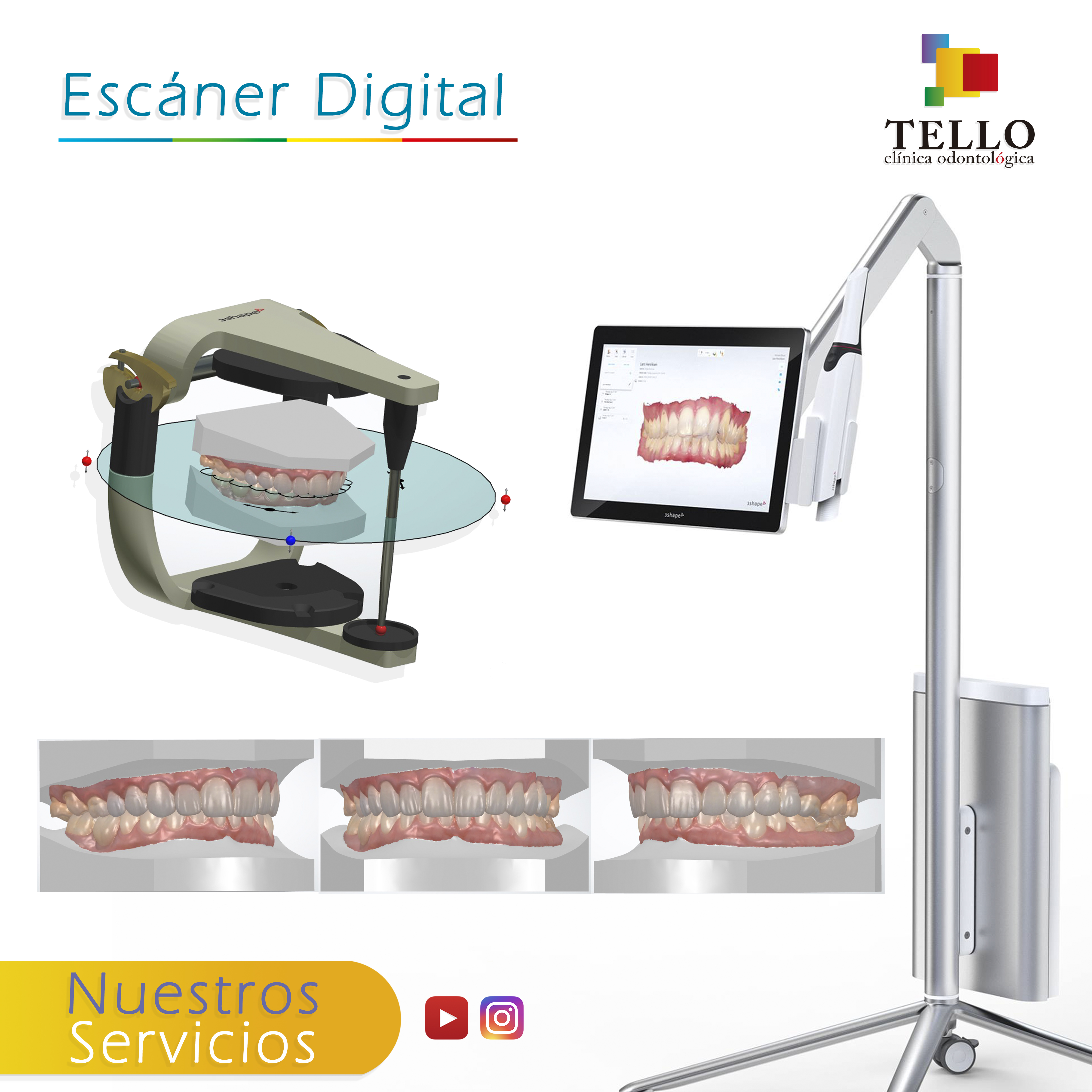 Escaneo digital Tello Odontología